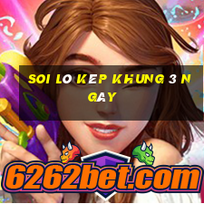 soi lô kép khung 3 ngày