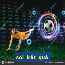 soi kết quả xổ số