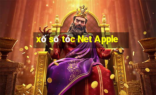 xổ số tóc Net Apple