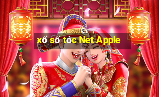 xổ số tóc Net Apple