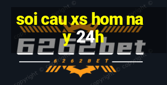 soi cau xs hom nay 24h