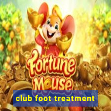 club foot treatment