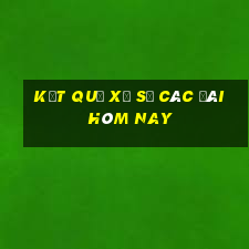 kết quả xổ số các đài hôm nay