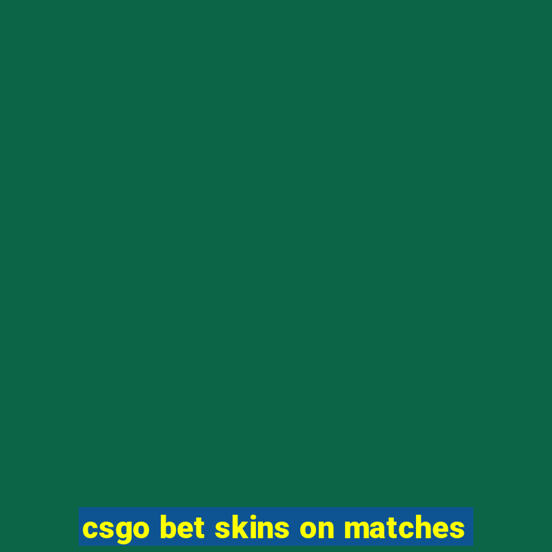 csgo bet skins on matches