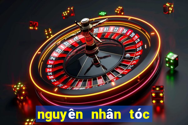 nguyên nhân tóc nhanh bết