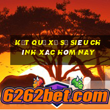 kết quả xổ số siêu chính xác hôm nay